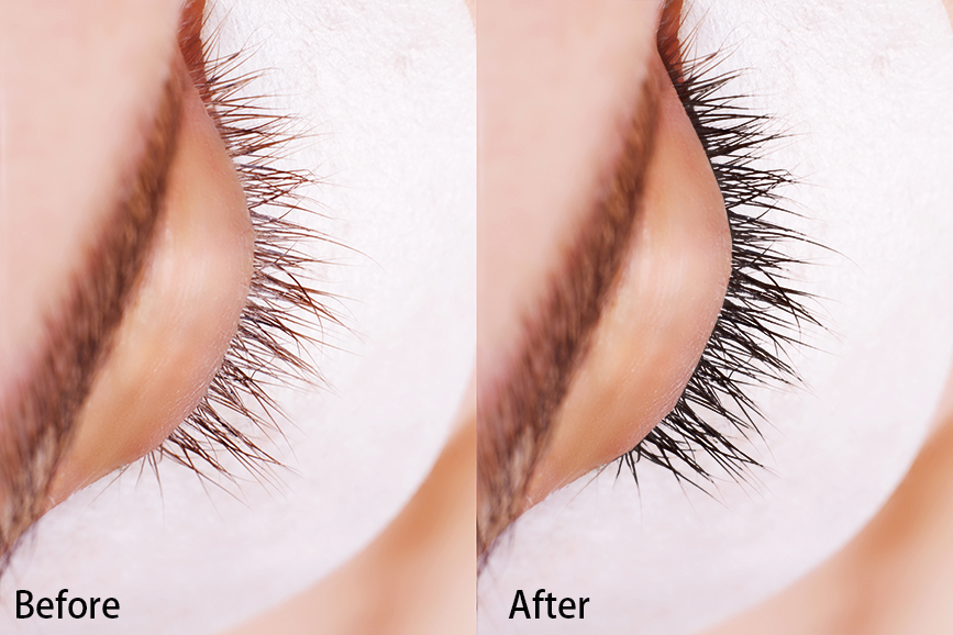 Eyelash Tine Procedure. Comparison of female eyes before and after.